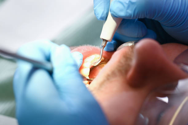 Best Emergency Root Canal Treatment in Hoboken, NJ