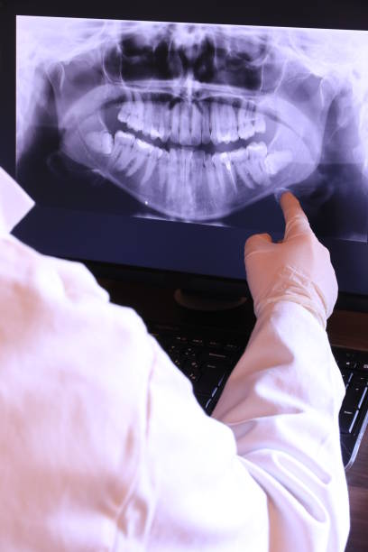 Best Emergency Dentist for Knocked-Out Tooth in Hoboken, NJ