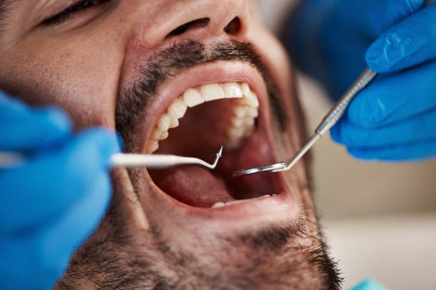 Best Broken or Cracked Tooth Emergency Dentist in Hoboken, NJ